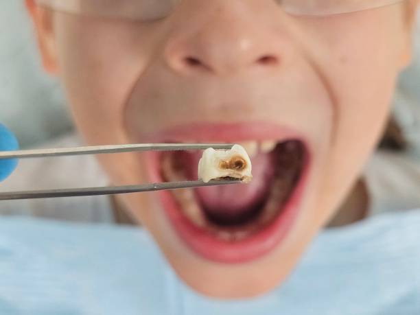 Best Emergency Cosmetic Dentistry in Baraga, MI